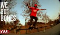 We Got Bones Trailer